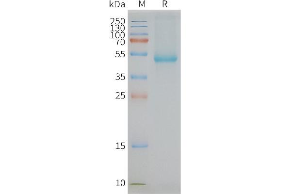 SLC7A11 Protein