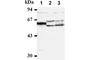 Western Blotting (WB) image for anti-Cell Division Cycle 25 Homolog A (S. Pombe) (CDC25A) antibody (ABIN487483) (CDC25A Antikörper)