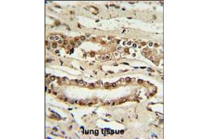 FOXP1 Antibody IHC analysis in formalin fixed and paraffin embedded lung tissue followed by peroxidase conjugation of the secondary antibody and DAB staining. (FOXP1 Antikörper  (C-Term))