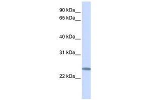 C12ORF49 antibody used at 1 ug/ml to detect target protein. (C12orf49 Antikörper  (C-Term))