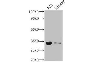 Western Blot Positive WB detected in: PC-3 whole cell lysate, Mouse kidney tissue All lanes: POLR2C antibody at 3. (POLR2C Antikörper  (AA 2-275))
