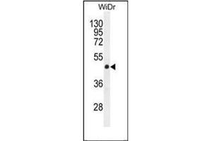 Western blot analysis of Gasdermin C Antibody (Center) in WiDr cell line lysates (35ug/lane). (MLZE Antikörper  (Middle Region))