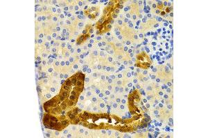 Immunohistochemistry (IHC) image for anti-Parvalbumin (PVALB) antibody (ABIN3016701) (PVALB Antikörper)