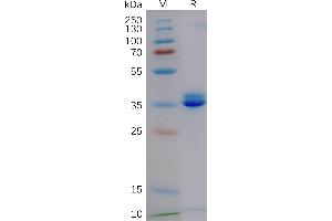 Cynomolgus GD Protein, hFc Tag on SDS-PAGE under reducing condition. (GPRC5D Protein (AA 1-21) (Fc Tag))
