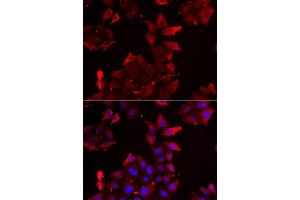 Immunofluorescence analysis of U2OS cells using PDLIM1 antibody. (PDLIM1 Antikörper)