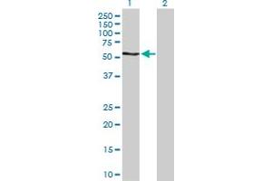 Western Blot analysis of RPS6KB2 expression in transfected 293T cell line by RPS6KB2 MaxPab polyclonal antibody. (RPS6KB2 Antikörper  (AA 1-482))