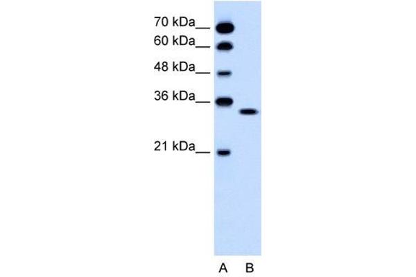 OR5T2 Antikörper  (C-Term)