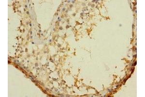 Immunohistochemistry of paraffin-embedded human testis tissue using ABIN7144247 at dilution of 1:100 (ASZ1 Antikörper  (AA 1-200))