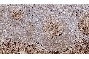 Human tonsil: immunohistochemical staining for Immunoglobulin G. (IgG Antikörper)