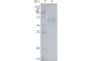 C5AR1 Protein