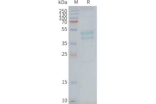 C5AR1 Protein