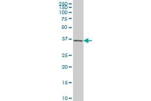 CXCR4 monoclonal antibody (M03), clone 2A9. (CXCR4 Antikörper  (AA 1-46))