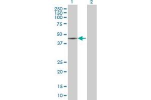 Lane 1: MVD transfected lysate ( 44. (MVD 293T Cell Transient Overexpression Lysate(Denatured))