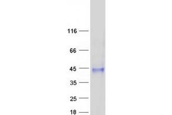 SUSD4 Protein (Transcript Variant 2) (Myc-DYKDDDDK Tag)