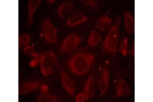 Immunofluorescence staining of methanol-fixed HeLa cells using NF-κB p65 (phospho-Ser468) antibody (E011013, Red) (NF-kB p65 Antikörper  (pSer468))