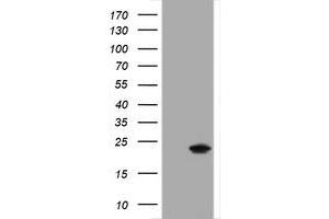 Western Blotting (WB) image for anti-Crystallin, alpha A (CRYAA) antibody (ABIN2715977) (CRYAA Antikörper)