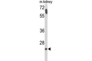 Western Blotting (WB) image for anti-Survival Motor Neuron Domain Containing 1 (SMNDC1) antibody (ABIN3004148) (SMNDC1 Antikörper)