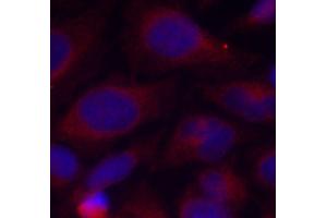 Immunofluorescence staining of methanol-fixed HeLa cells using Phospho-NFKB1-S893 antibody (ABIN2988205). (NFKB1 Antikörper  (pSer893))