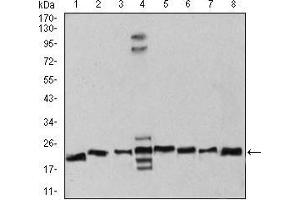 Western blot analysis using RAN mouse mAb against Hela (1), NIH/3T3 (2), A431 (3), C6 (4), Jurkat (5), Hela (6), COS7 (7), and Jurkat (8) cell lysate. (RAN Antikörper  (AA 1-216))