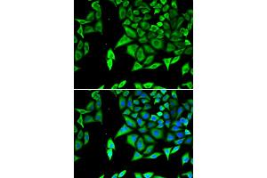 Immunofluorescence analysis of U2OS cells using NPPA antibody. (NPPA Antikörper)