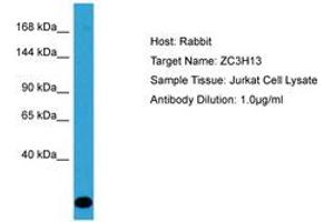 Image no. 1 for anti-Zinc Finger CCCH-Type Containing 13 (ZC3H13) (AA 1455-1504) antibody (ABIN6750587) (ZC3H13 Antikörper  (AA 1455-1504))