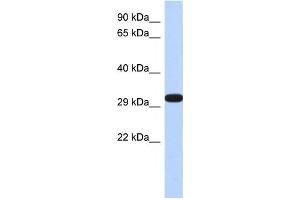 Western Blotting (WB) image for anti-Dimethylarginine Dimethylaminohydrolase 2 (DDAH2) antibody (ABIN2460078) (DDAH2 Antikörper)