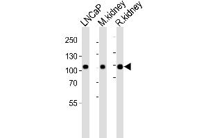 Western blot analysis of lysates from LNCaP cell line, mouse kidney, rat kidney tissue lysate(from left to right), using E Antibody (Center) (ABIN6243088 and ABIN6577473). (MME Antikörper  (AA 492-525))