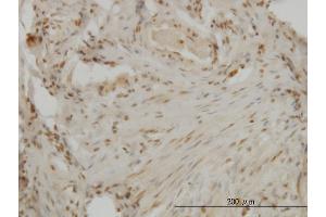 Immunoperoxidase of monoclonal antibody to DLX2 on formalin-fixed paraffin-embedded human ovary. (DLX2 Antikörper  (AA 1-110))