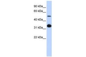 Image no. 1 for anti-Growth Differentiation Factor 2 (GDF2) (AA 360-409) antibody (ABIN6743828) (GDF2 Antikörper  (AA 360-409))