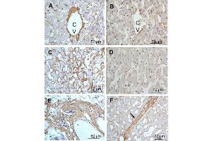 Immunohistochemistry (IHC) image for anti-Collagen, Type III (COL3) antibody (ABIN5596830)