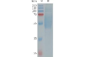 Human IL1RL2 Protein, His Tag on SDS-PAGE under reducing condition. (IL1RL2 Protein (AA 20-335) (His tag))
