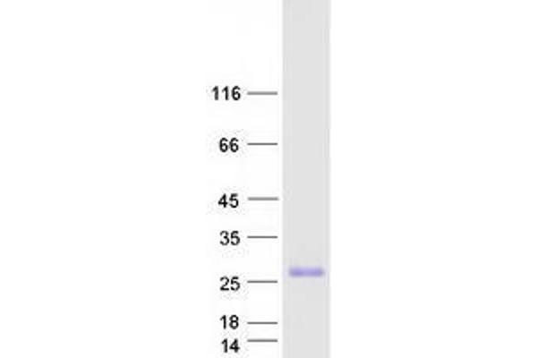 TMIE Protein (Myc-DYKDDDDK Tag)