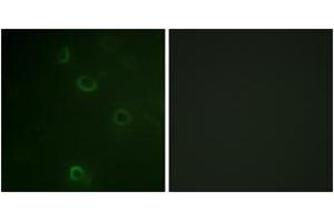 Immunofluorescence analysis of COS7 cells, using ATPase (Ab-16) Antibody. (ATPase Antikörper  (AA 5-54))