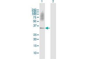 Western Blot analysis of SGCD expression in transfected 293T cell line by SGCD MaxPab polyclonal antibody. (SGCD Antikörper  (AA 1-290))