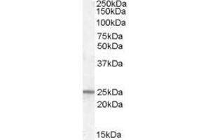 Western Blotting (WB) image for anti-Progesterone Receptor Membrane Component 1 (PGRMC1) antibody (ABIN5873921) (PGRMC1 Antikörper)
