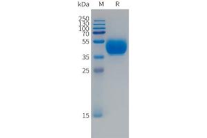 FCRL5 Protein (Fc Tag)