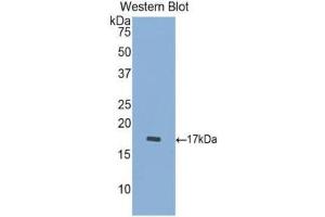 Western Blotting (WB) image for anti-Cathepsin D (CTSD) (AA 23-161) antibody (ABIN1174453) (Cathepsin D Antikörper  (AA 23-161))