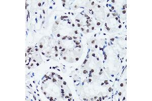 Immunohistochemistry of paraffin-embedded human stomach using Symmetric DiMethyl-Histone H3-R2 antibody (ABIN3016053, ABIN3016054, ABIN3016055, ABIN1680220 and ABIN6219534) at dilution of 1:100 (40x lens). (Histone 3 Antikörper  (H3R2me2))