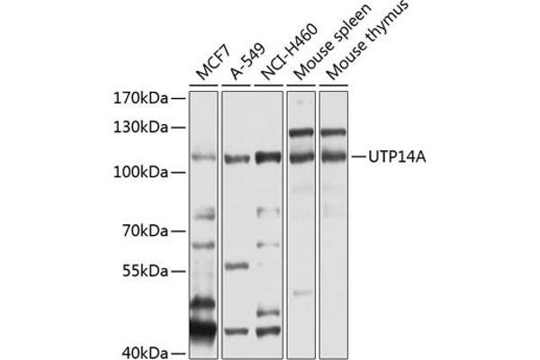 UTP14A Antikörper  (AA 1-260)