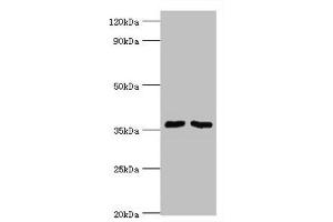 Western blot All lanes: Methylosome protein 50 antibody at 6 μg/mL Lane 1: Hela whole cell lysate Lane 2: HepG2 whole cell lysate Secondary Goat polyclonal to rabbit IgG at 1/10000 dilution Predicted band size: 37, 30 kDa Observed band size: 37 kDa (WDR77 Antikörper  (AA 1-260))