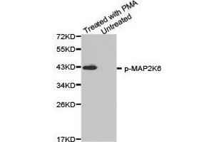Western Blotting (WB) image for anti-Mitogen-Activated Protein Kinase Kinase 6 (MAP2K6) (pSer207) antibody (ABIN1870361) (MAP2K6 Antikörper  (pSer207))