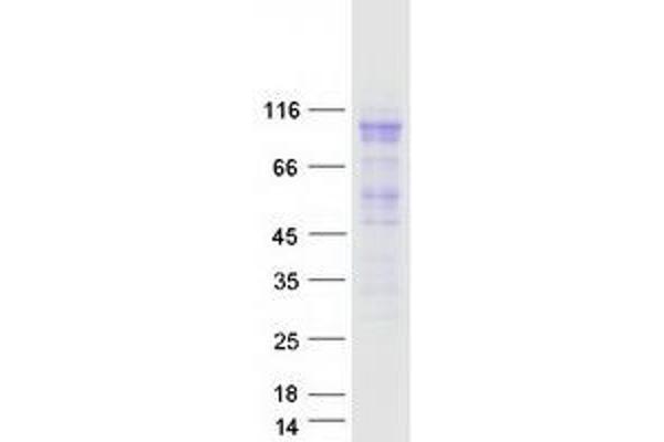 MCM4 Protein (Transcript Variant 1) (Myc-DYKDDDDK Tag)