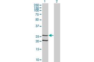 Western Blot analysis of IL6 expression in transfected 293T cell line by IL6 monoclonal antibody (M07), clone 1G8. (IL-6 Antikörper  (AA 29-212))
