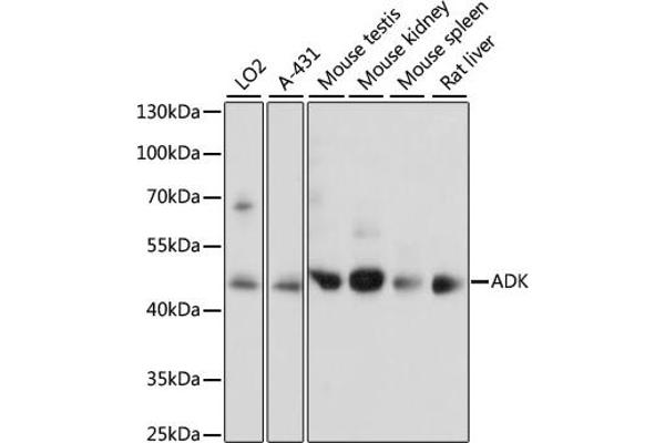 ADK Antikörper  (AA 200-345)