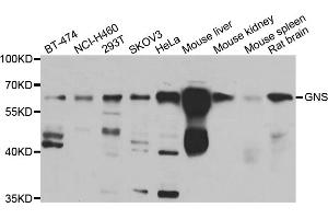 Western blot analysis of extracts of various cell lines, using GNS antibody (ABIN5975568) at 1/1000 dilution. (GNS Antikörper)