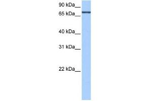 ADAD2 antibody used at 0. (ADAD2 Antikörper  (C-Term))