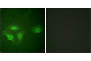 Immunofluorescence analysis of HepG2 cells, using HDAC6 (Phospho-Ser22) Antibody. (HDAC6 Antikörper  (pSer22))