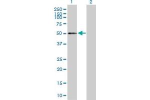 Western Blot analysis of CD177 expression in transfected 293T cell line by CD177 MaxPab polyclonal antibody. (CD177 Antikörper  (AA 1-437))