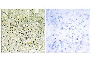 Immunohistochemistry (IHC) image for anti-Lectin, Galactoside-Binding, Soluble, 8 (LGALS8) (Internal Region) antibody (ABIN1850470) (LGALS8 Antikörper  (Internal Region))