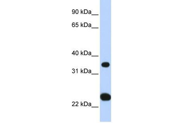 SLC25A35 Antikörper  (N-Term)